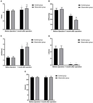 Analysis of the Effect of Phacoemulsification and Intraocular Lens Implantation Combined With Trabeculectomy on Cataract and Its Influence on <mark class="highlighted">Corneal Endothelium</mark>